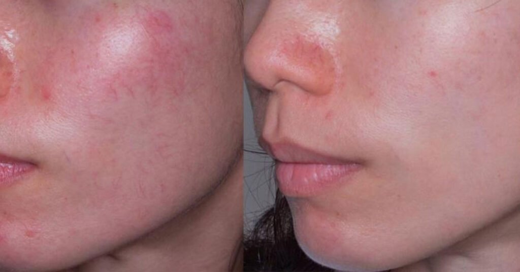 a2-quadro-star-pro-yellow_kuperoz_1020x628px