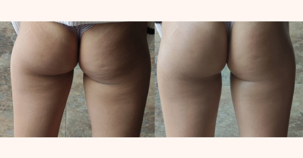 robolex_before_after_1