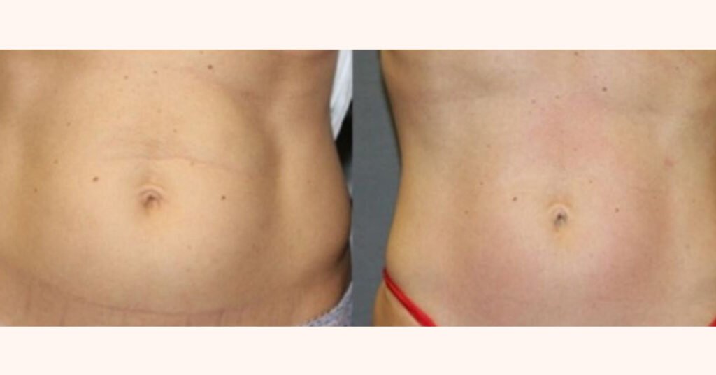 robolex_before_after_2