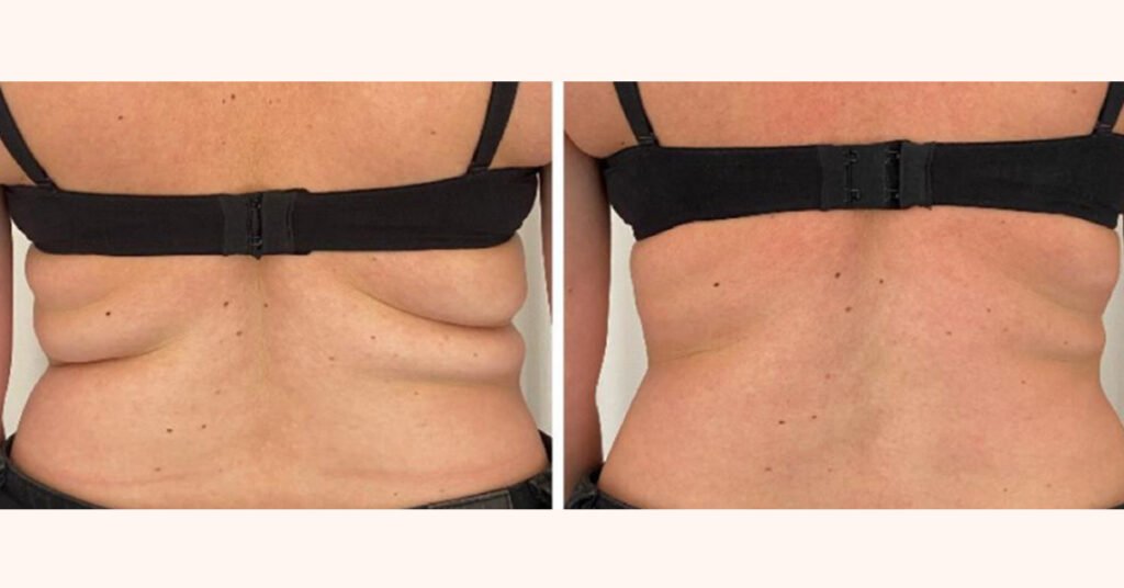 robolex_before_after_4